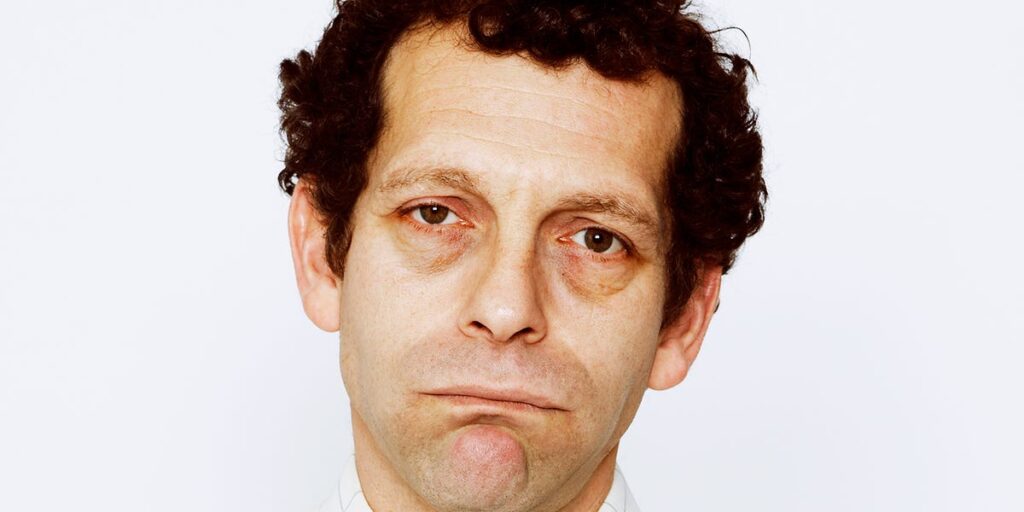 علت پف زیر چشم